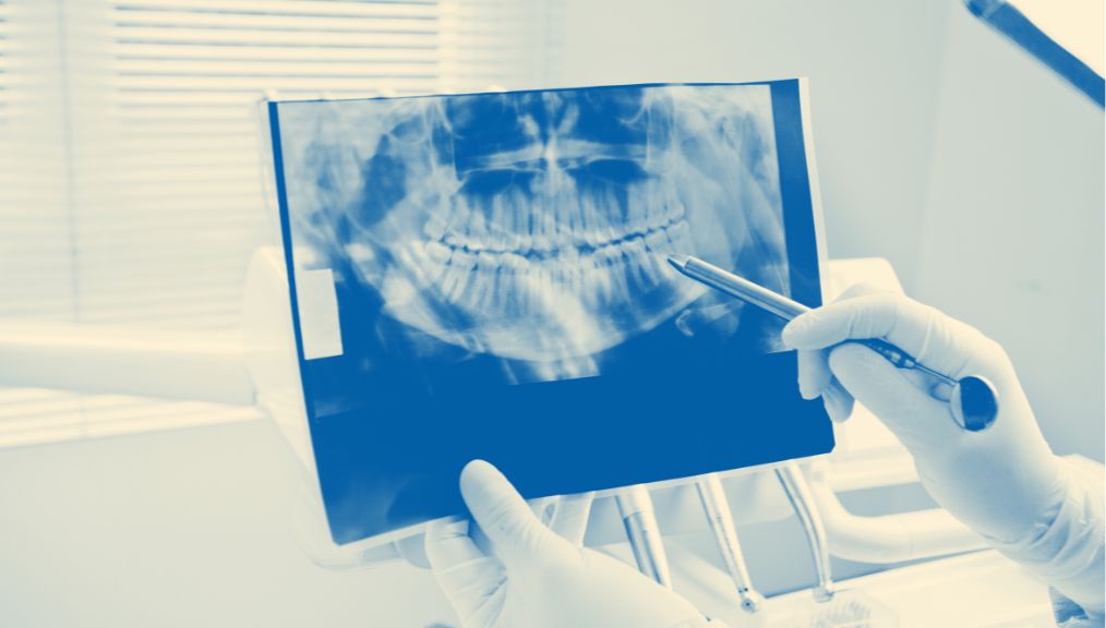 oral-cancer-screening-bentley