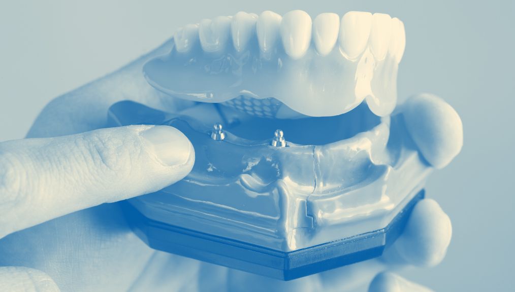 dentures-dentist-alberta